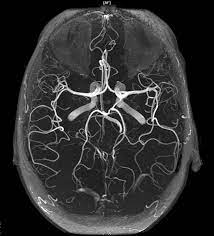 МРТ головного мозга + артерий головного мозга + вен головного мозга